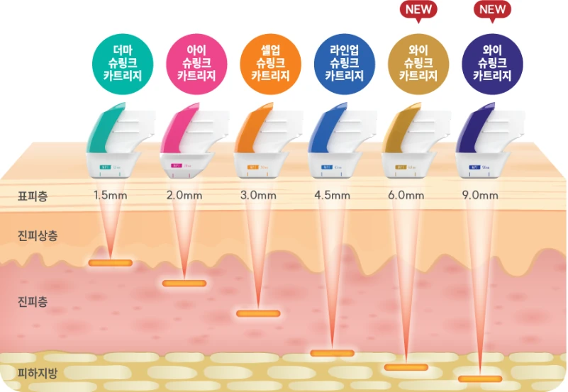 여섯 가지 카트리지가 1.5mm에서 9.0mm까지 서로 다른 깊이에 초음파를 모으는 제조사 공식 도해