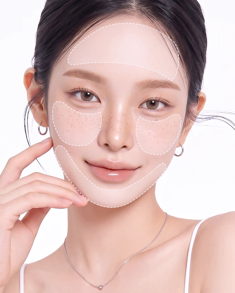 페이스 리프팅 시술 범위