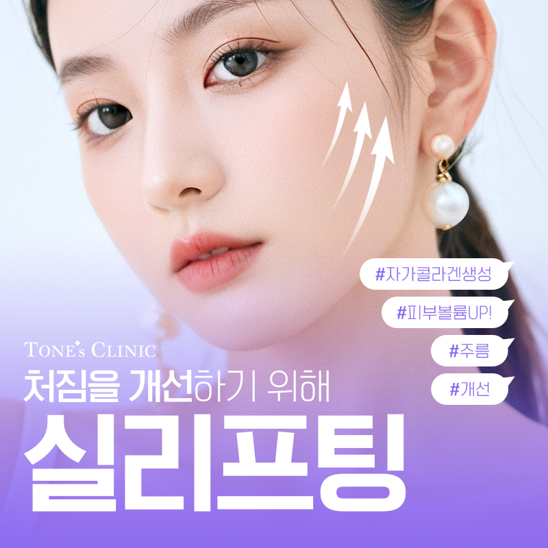 실리프팅