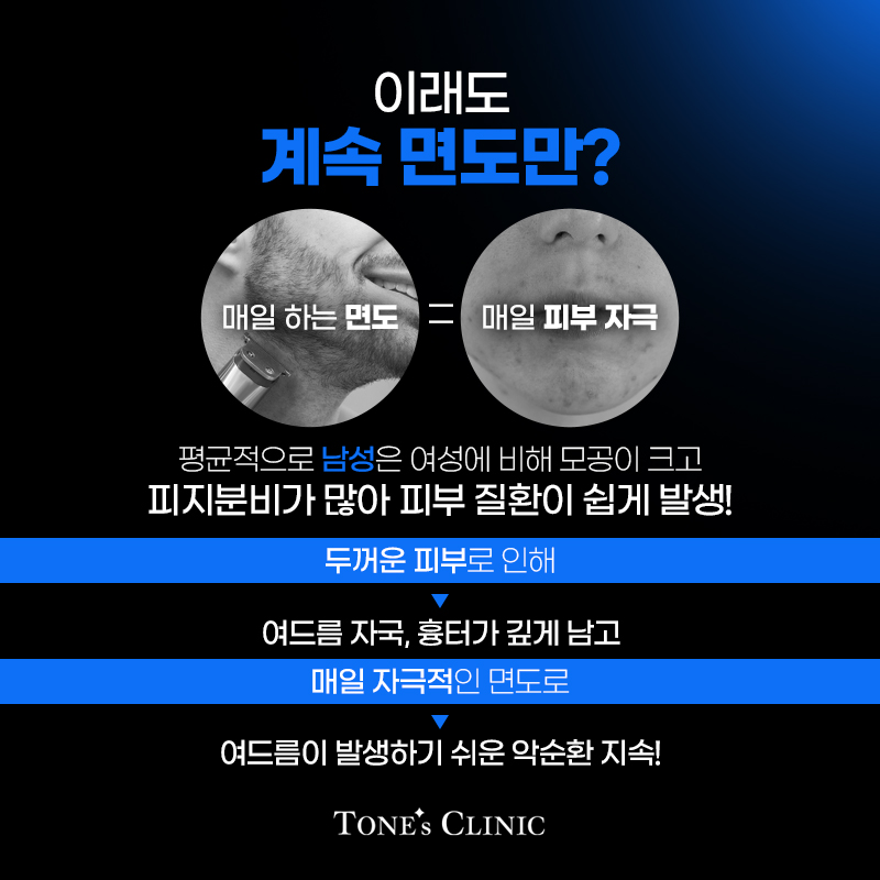 수염제모