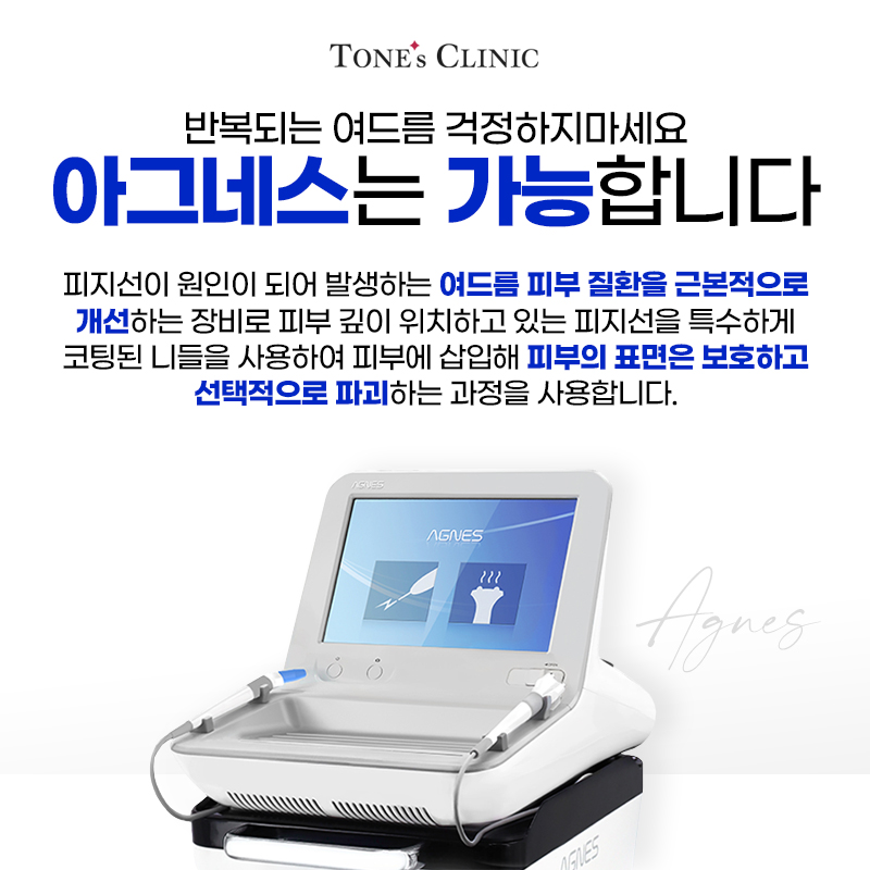 아그네스
