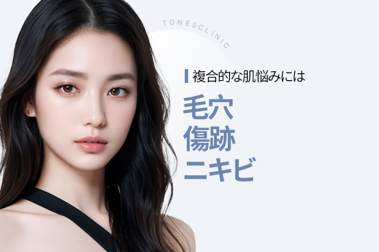 毛穴・ニキビ・ニキビ跡