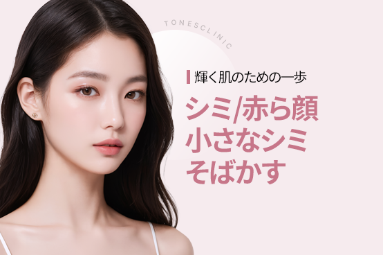 レーザー