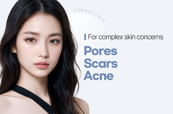 Pores/Acne/Scars