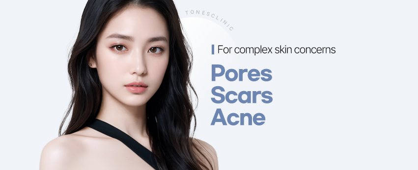 Pores/Acne/Scars
